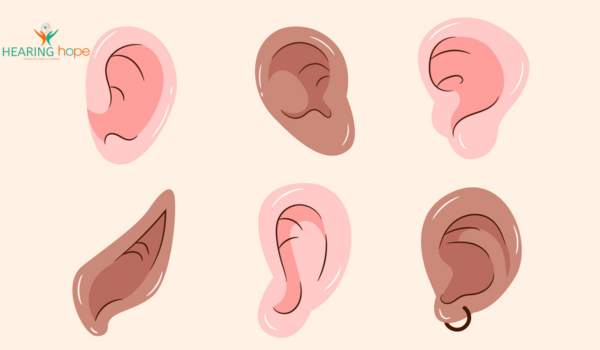 Ear Mould Types