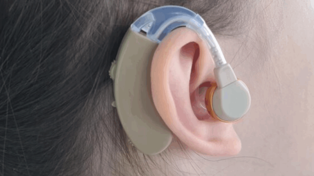 ITC Hearing Aid